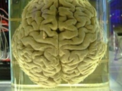 474px-human-brain_257